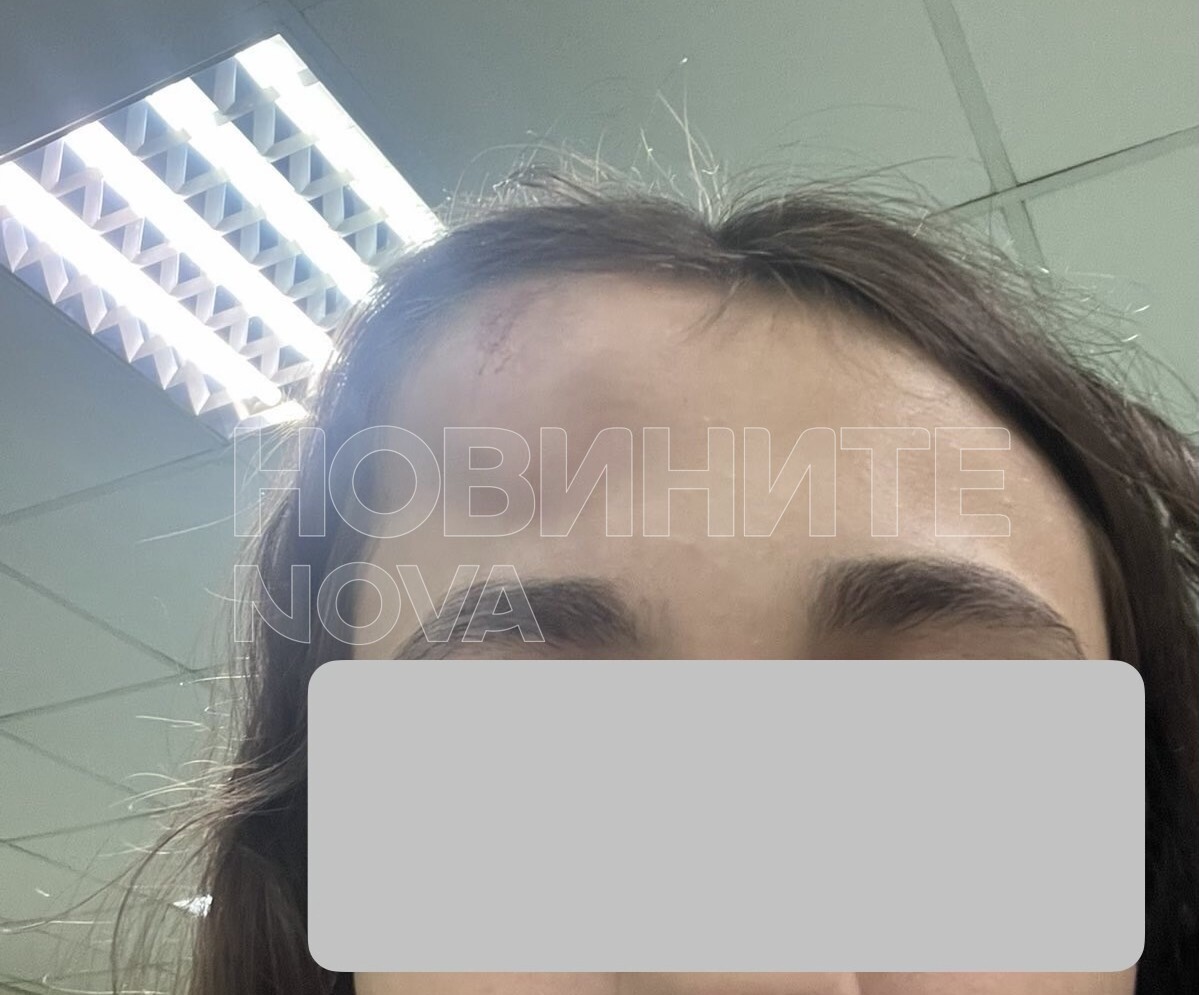 снимка