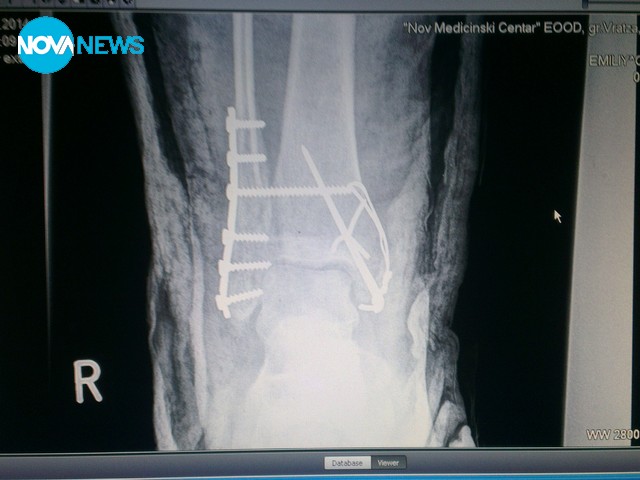 Застраховани ли сме в градския и междуградския транспорт като пътници?