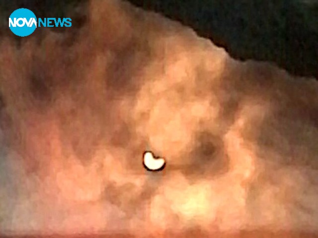 Слънчево затъмнение над Долна баня