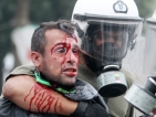 Десетки ранени при бурните протести срещу икономическите мерки в Гърция