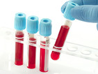 Разработиха "универсален" кръвен тест за рак