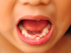 7-годишнa индийка има 202 зъба