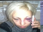 Жена твърди, че е бита от полицай в метрото
