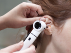 Загубата на слух може да се повлияе от вирус