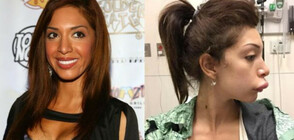 Звездни жертви на пластичната хирургия (ГАЛЕРИЯ)