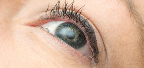 Извадиха 4 пчели от окото на жена, хранели се със сълзите й