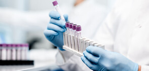 Лекарство срещу зъбобол боядиса кръвта на американка в синьо (СНИМКА)