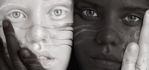 ЧУДО НА ПРИРОДАТА: Близнаци с различен цвят на кожата (ГАЛЕРИЯ)