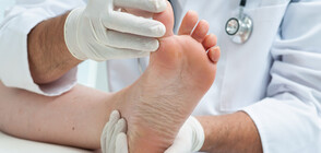 Нов симптом на COVID-19 "оцветява" пръстите на краката