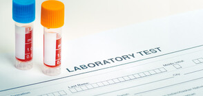 Предлагат PCR тест да се назначава при появата на пет симптома