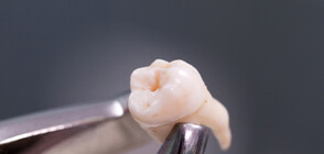 Учени: Изваждането на мъдреците може да стимулира вкусовите рецептори