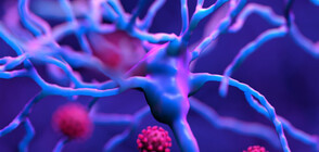 Учени търсят връзка между COVID-19 и Алцхаймер