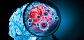 Изследване: COVID-19 може да наруши мозъчната функция