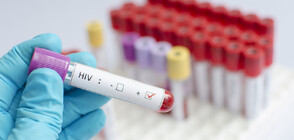 СЗО предупреждава: Броят на случаите на ХИВ в Европа расте