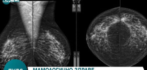 Защо са важни профилактичните прегледи за рак на гърдата