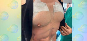 Филип Киркоров се сдоби плочки и стегнати гърди с операция (ВИДЕО)