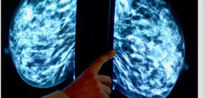 Разработват уред за проследяване на рак на гърдата, вграден в сутиен