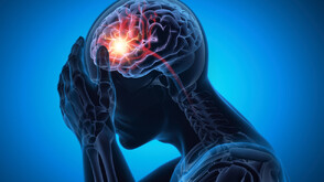 На Световния ден за борба с инсулта: За какви симптоми да внимаваме