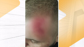 Година след бруталното нападение над младеж с боксове и бухалки: Двама непълнолетни са с административно наказание