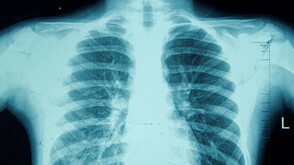 За образните методи в диагностиката и проследяването на заболяванията