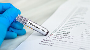 Първи случай на треска чикунгуня у нас