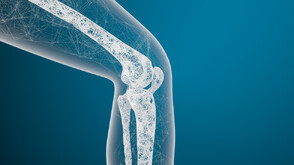 Остеопороза – кои са симптомите, които не бива да подценяваме?