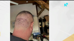 Завързан с белезници и ритан в главата: Мъж твърди, че е жестоко пребит в дискотека в Троян