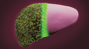 Биофилтър спасява черния дроб