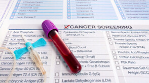 Провериха обществена поръчка на тестове за скриниг на рак заради съмнения за завишени цени