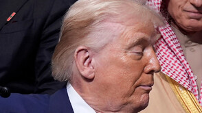 Доналд Тръмп е подложен на лечение заради обрив