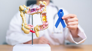 Ракът на дебелото черво: Значението на ранната диагностика и превенцията