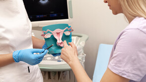 Ендометриозата – кога менструалните болки са симптом на болестта