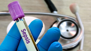 Сепсисът - тихият убиец: Кога инфекцията става животозастрашаваща