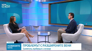 Д-р Владо Галчев: Жегата влияе на кръвоносните съдовете, не пренебрегвайте симптомите
