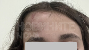 Майка на дете, ударено от паднал клон във Варна, ще съди Общината (СНИМКИ)
