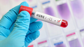Потвърдиха първия за сезона случай на грип H1N1 у нас