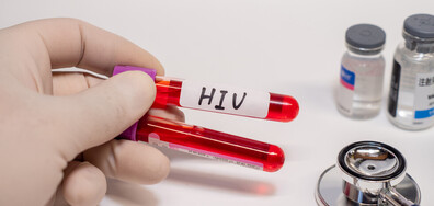 Три жени са заразени с ХИВ след козметична процедура в САЩ