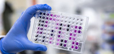 Директор на лаборатория: PCR тестът за коклюш не може да бъде фалшиво положителен