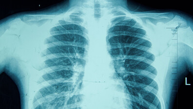 За образните методи в диагностиката и проследяването на заболяванията