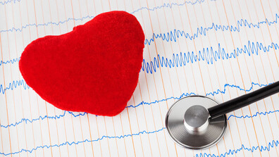 Как електрофизиолозите спасяват сърцето при аритмия