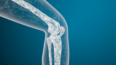 Остеопороза – кои са симптомите, които не бива да подценяваме?