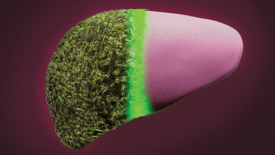 Биофилтър спасява черния дроб