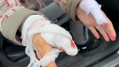 Агресивно куче нахапа жена и домашния ѝ любимец в Казанлък