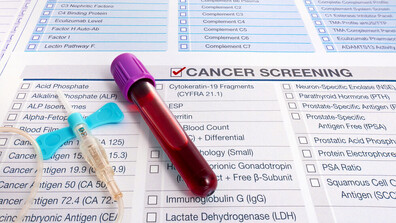 Провериха обществена поръчка на тестове за скриниг на рак заради съмнения за завишени цени