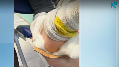 Проверка след сигнал: Обездвижили счупен крак на дете с картон в Спешния център в Разлог