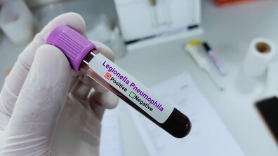 Жена почина от легионерска болест в Бургас