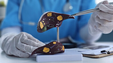 Какви са възможните причини за увреждане на черния дроб