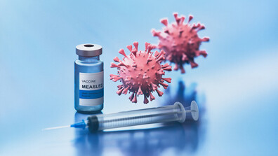 Случаите на морбили във Врачанско се увеличават: Какви са рисковете и симптомите?