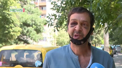 „Пребиха ме за една енергийна напитка“: Таксиметров шофьор разказва за побой срещу него