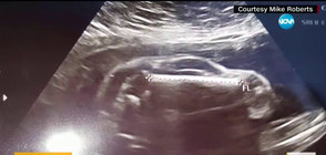 Млада жена в САЩ е "бременна с автомобил"